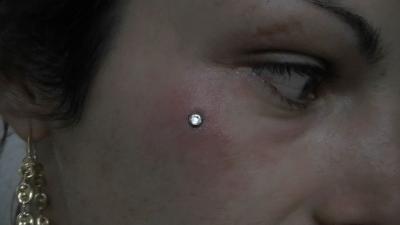 Piercing - piercings de surface - piercing de surface sur la pommette