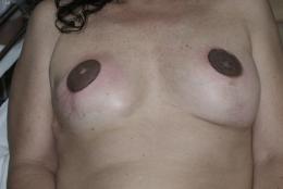 Aroles de seins Ralises par Serge Tattoo Evolution Perpignan