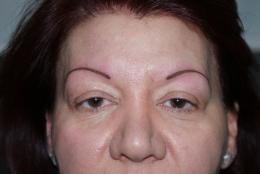 Deuxim etape....Finition des deux sourcils . Serge Tattoo Evolution Perpignan.